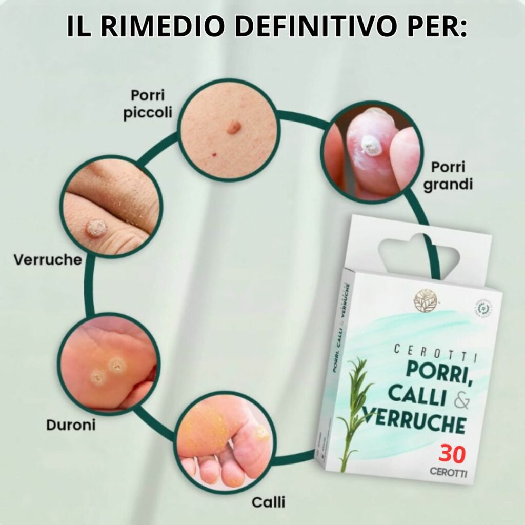 cerotti-porri