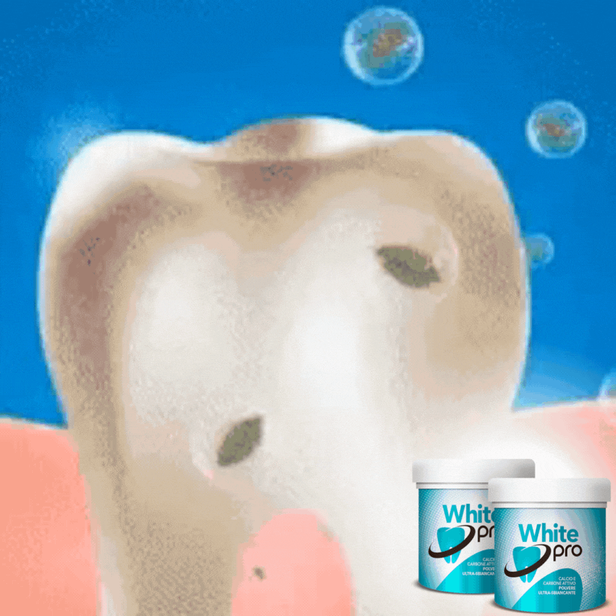 prodotti per lo sbiancamento dei denti